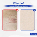 Ironridge® Tapijt- en Bekledingreiniger Premium – Krachtige Reiniging – Met Meerdere Opzetstukken – Voor Vlekken & Diepe Reiniging – Geschikt voor Banken, Tapijten & Autostoelen – Voor een Fris & Schoon Resultaat – Compact & Gebruiksvriendelijk Design
