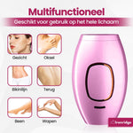 Ironridge® Laser Ontharingsapparaat Deluxe – Pijnarm – Met IPL-Technologie – 5 Intensiteitsniveaus – Voor Gezicht & Lichaam – Voor Langdurig Gladde Huid – Duurzaam Verzorgingsapparaat