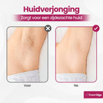 Ironridge® Laser Ontharingsapparaat Deluxe – Pijnarm – Met IPL-Technologie – 5 Intensiteitsniveaus – Voor Gezicht & Lichaam – Voor Langdurig Gladde Huid – Duurzaam Verzorgingsapparaat