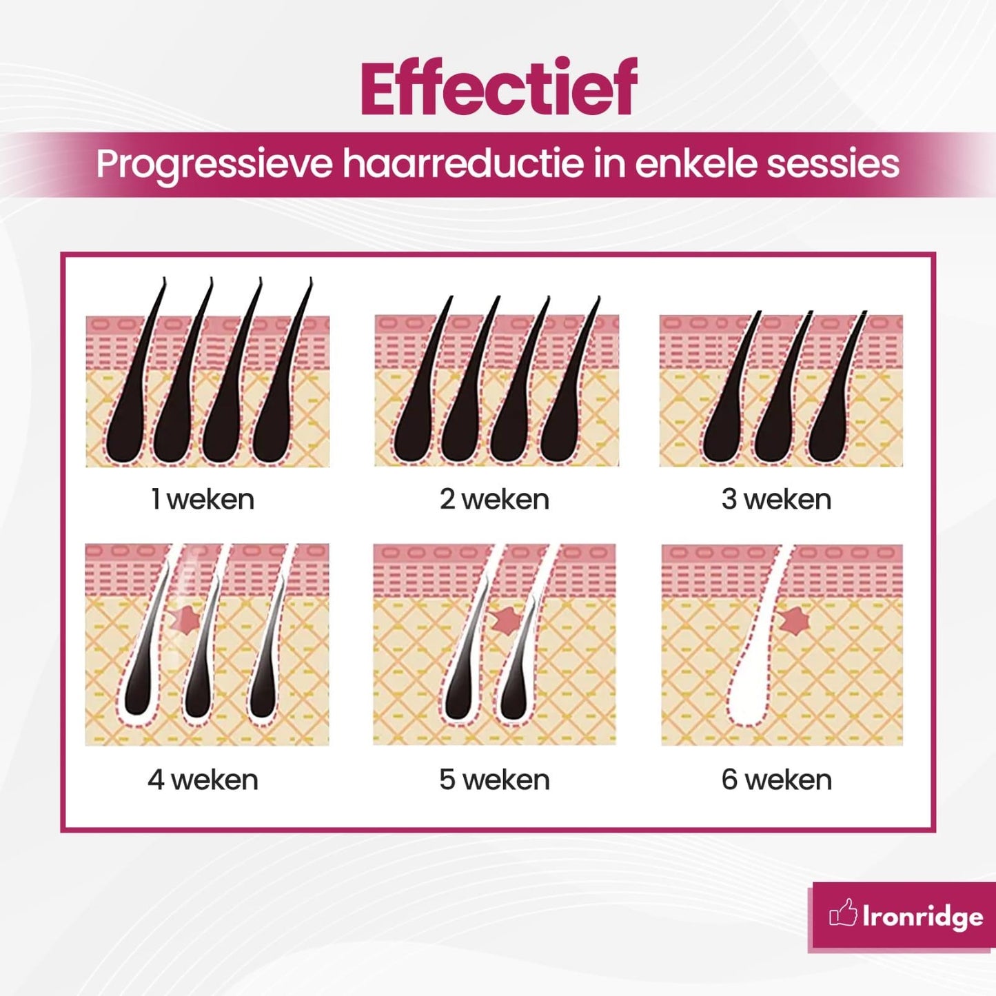 Ironridge® Laser Ontharingsapparaat Deluxe – Pijnarm – Met IPL-Technologie – 5 Intensiteitsniveaus – Voor Gezicht & Lichaam – Voor Langdurig Gladde Huid – Duurzaam Verzorgingsapparaat