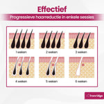 Ironridge® Laser Ontharingsapparaat Deluxe – Pijnarm – Met IPL-Technologie – 5 Intensiteitsniveaus – Voor Gezicht & Lichaam – Voor Langdurig Gladde Huid – Duurzaam Verzorgingsapparaat